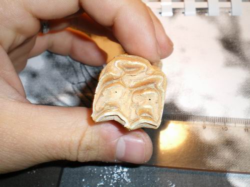 Dentone!